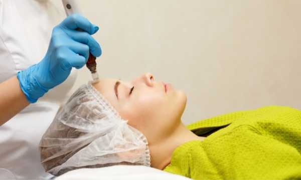 Microneedling Treatment In Lutz FL Prime Aesthetica