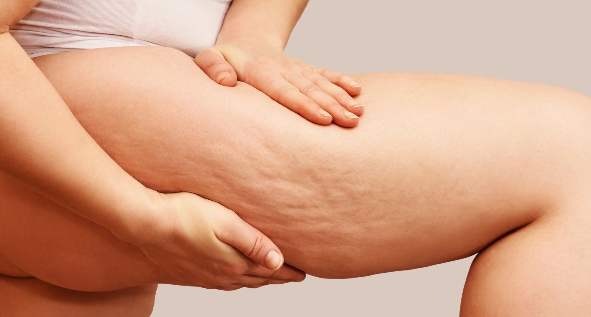 Cellulite Treatment - Causes, Risk Factors, Treatment, Alternative