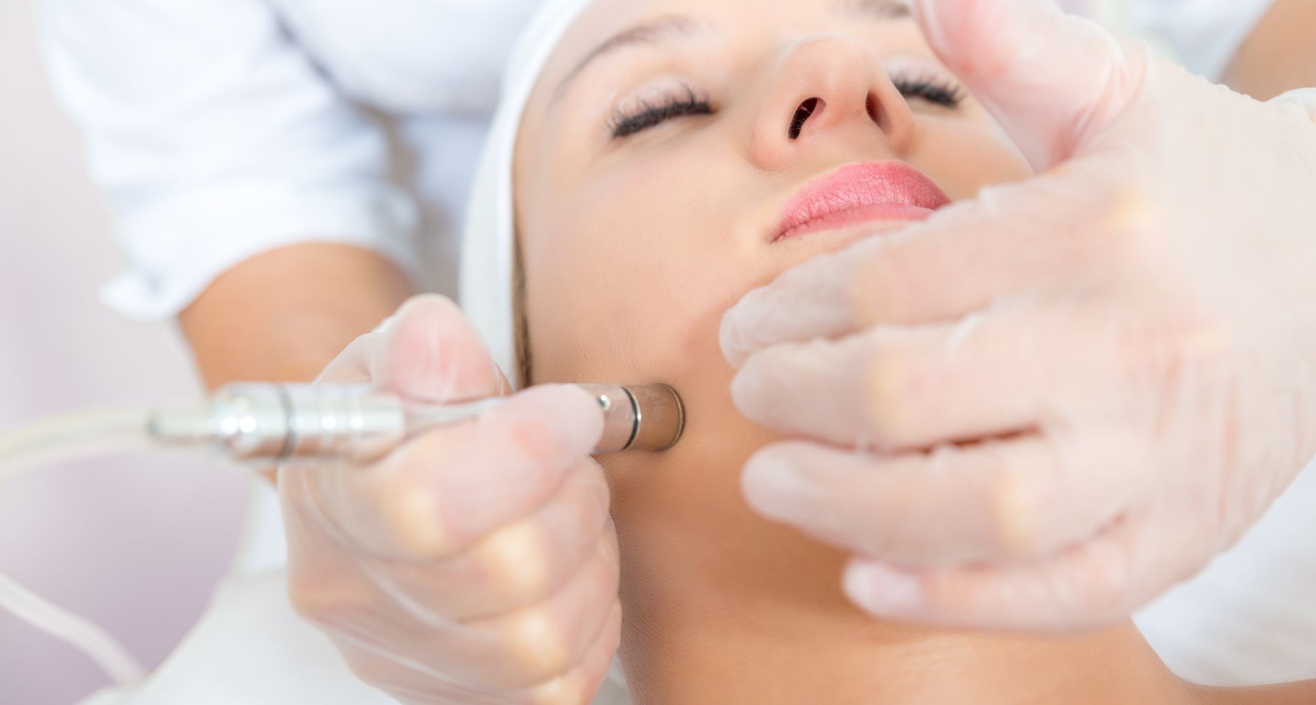 Is Microdermabrasion An Effective Treatment For Acne Scars 1134