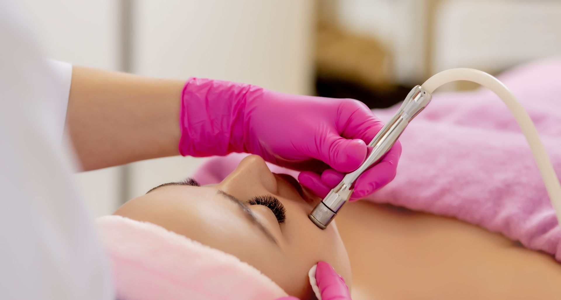 Is Microdermabrasion An Effective Treatment For Acne Scars 7004